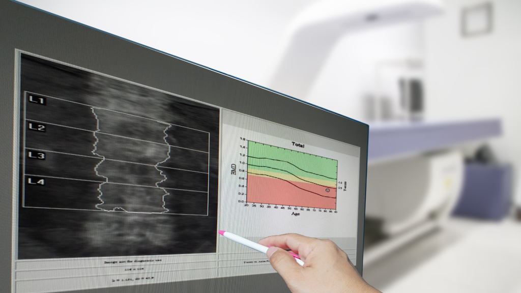 Densitometria óssea